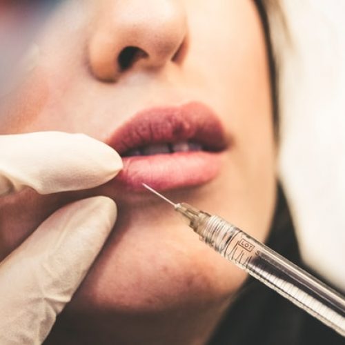 dermal fillers easy dermatologist